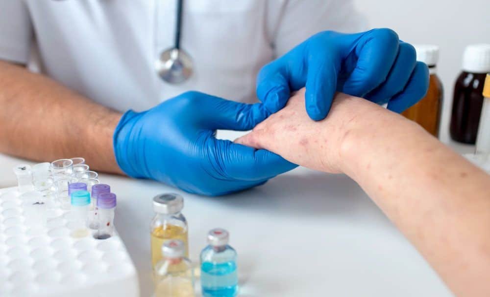 skin rash prevention
