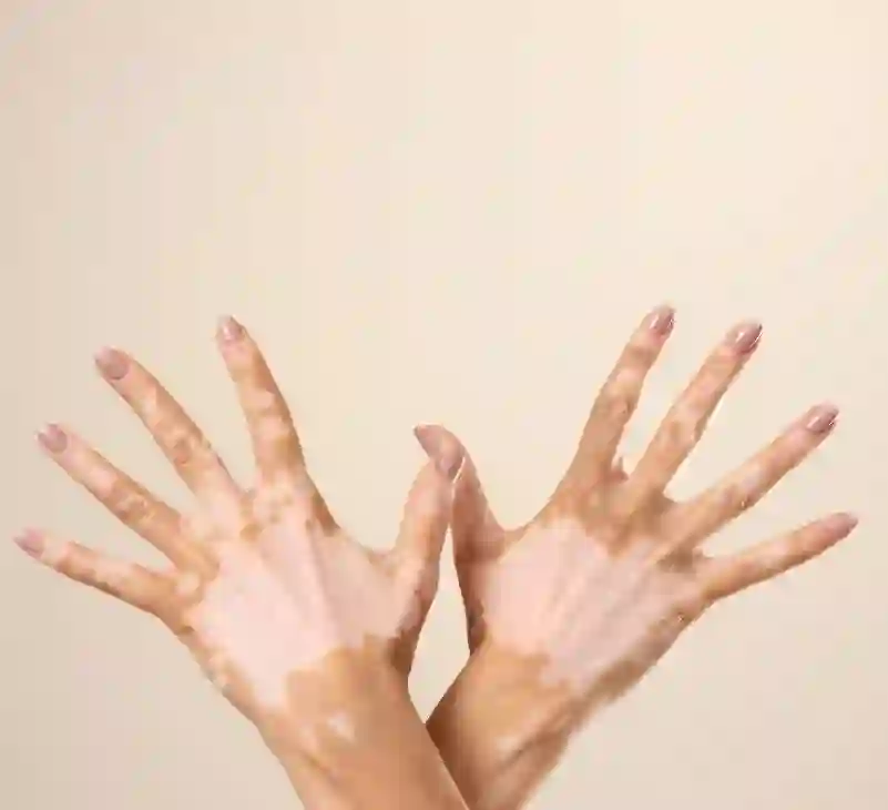 jpg