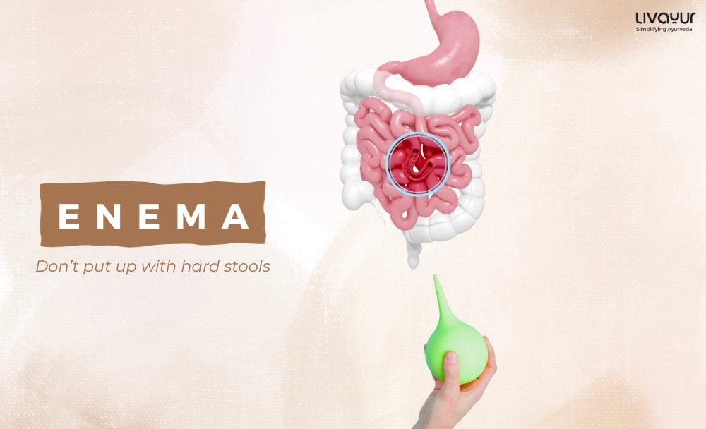 Enema What is it, Benefits, Uses, Procedure & Side Effects (2) Enema What is it Benefits Uses Procedure Side Effects 2