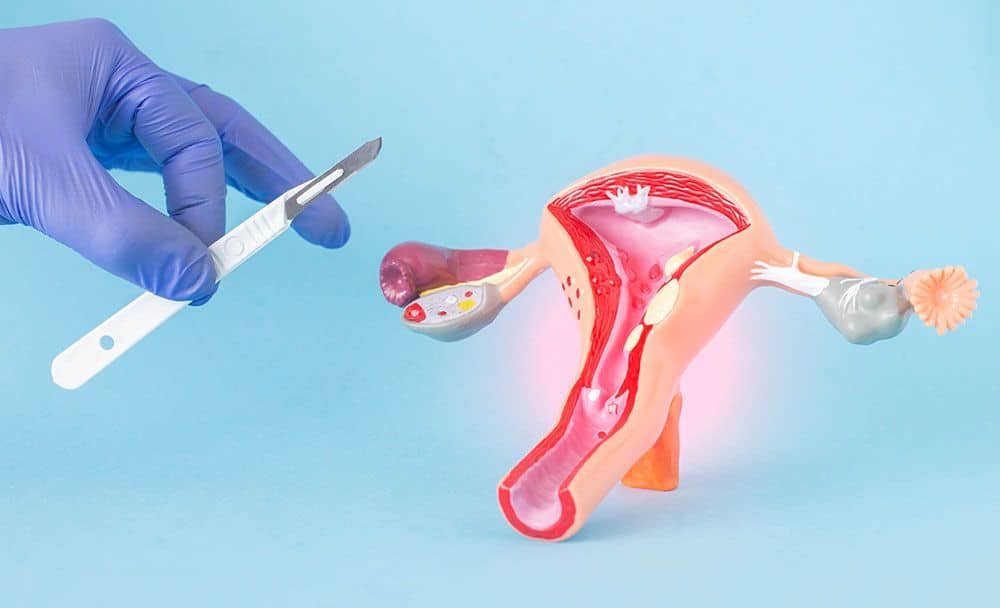 symptoms of vaginal cysts