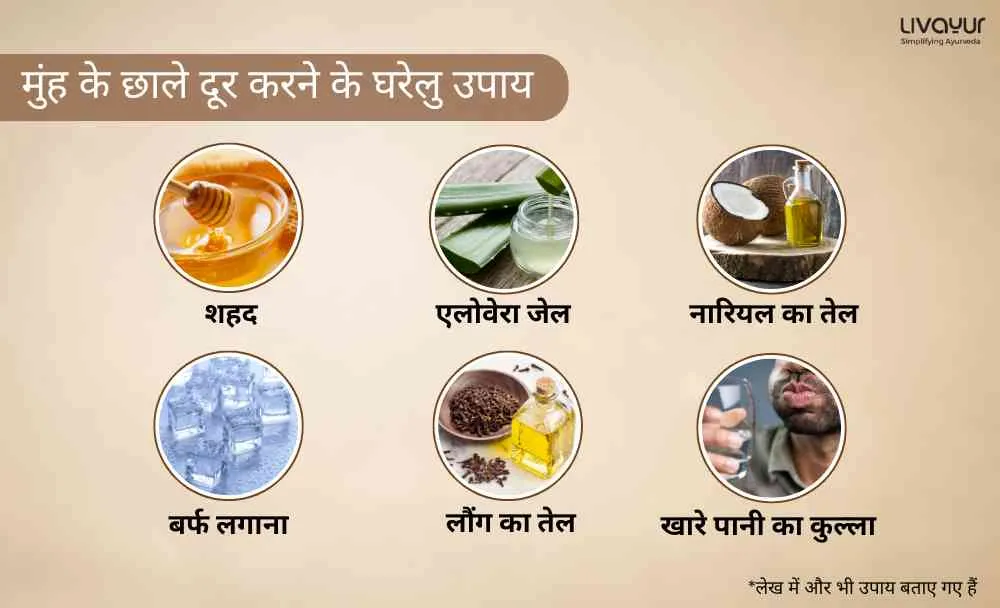 मुंह के छाले दूर करने के घरेलु उपाय_27 मुंह के छाले दूर करने के घरेलु उपाय 27